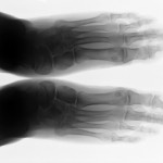 orthopedic EHR x-ray image